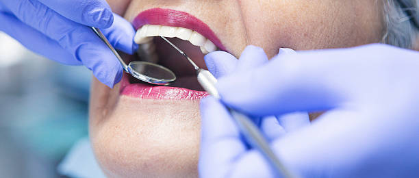 Fast & Reliable Emergency Dental Services in CA